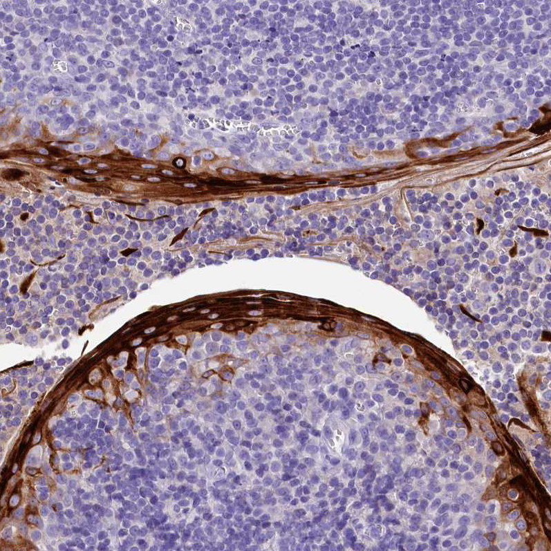 Atlas Antibodies